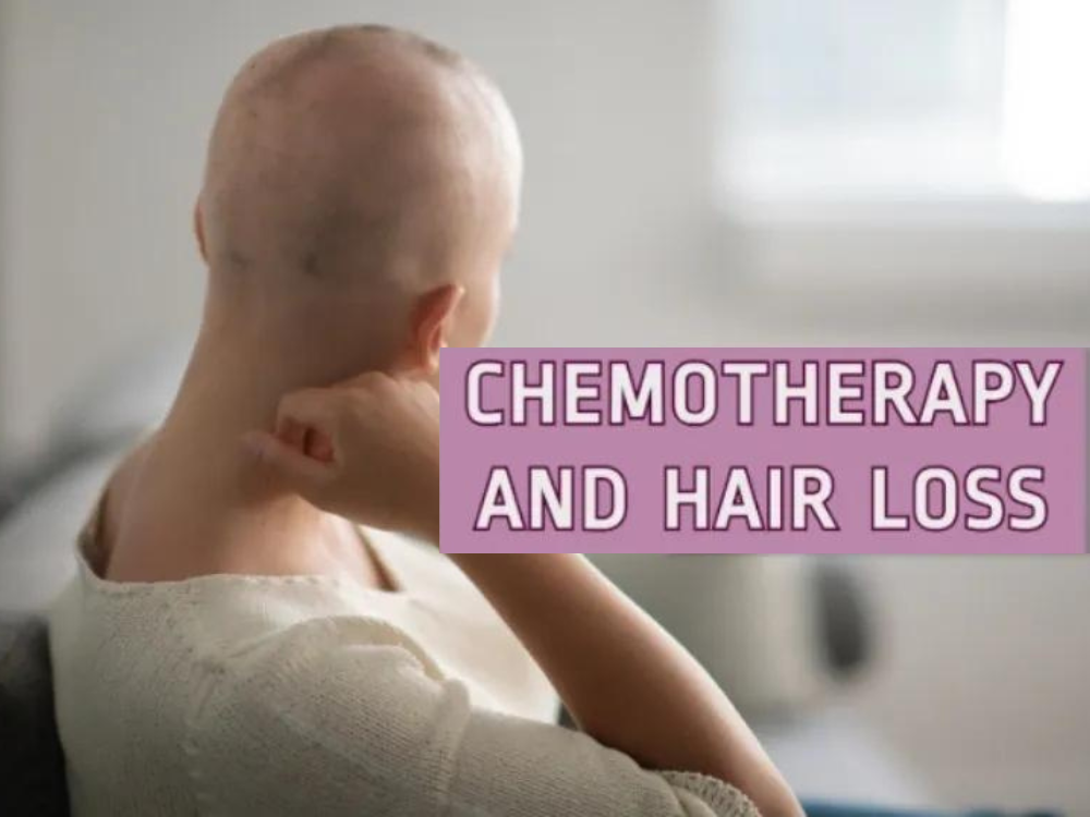 Understanding and Managing Chemotherapy-Related Hair Loss